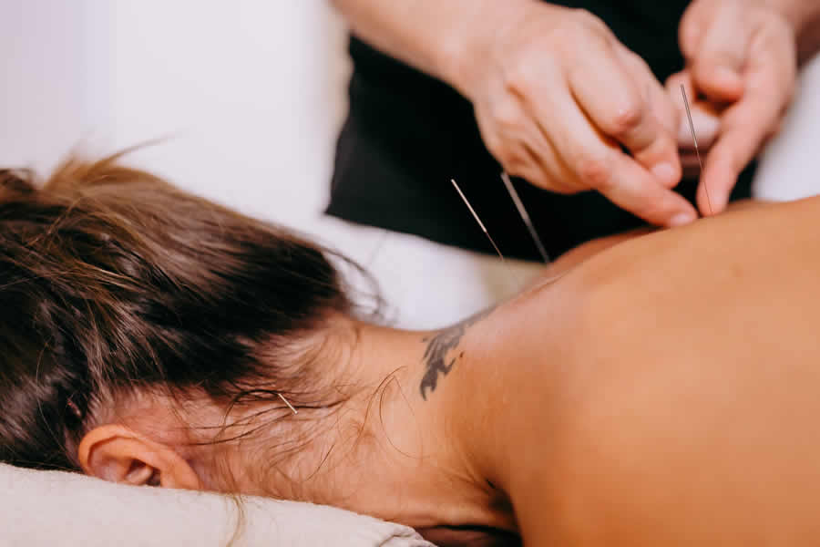 Image of Acupuncture Services Image of Acupuncture Services